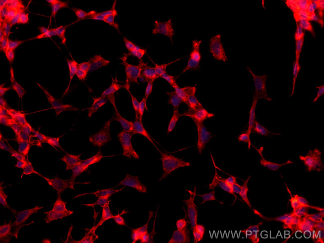 Drebrin Antibody in Immunocytochemistry (ICC/IF)