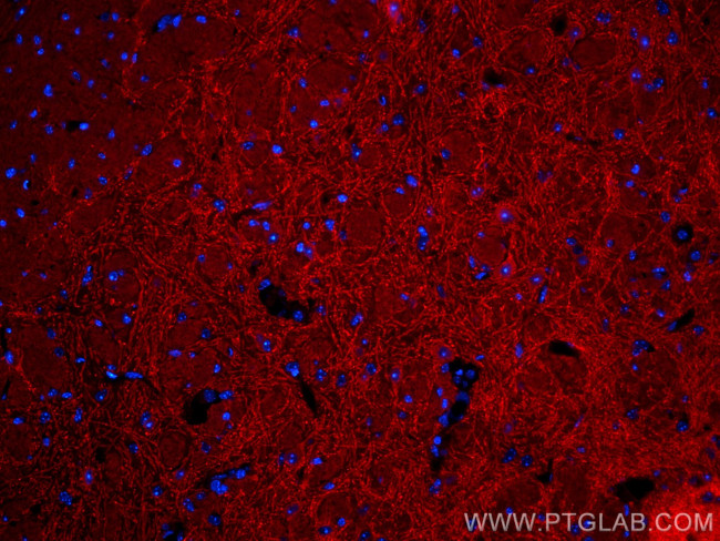 Drebrin Antibody in Immunohistochemistry (PFA fixed) (IHC (PFA))