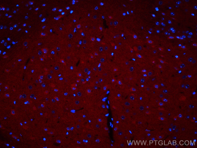 GRIA1 Antibody in Immunohistochemistry (PFA fixed) (IHC (PFA))