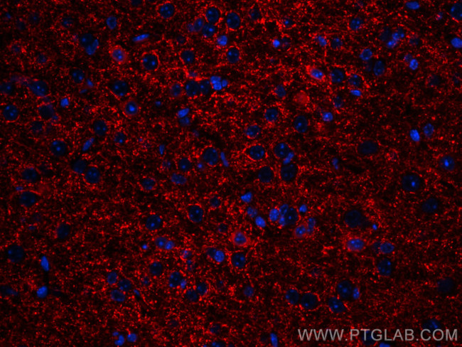 GAD1 Antibody in Immunohistochemistry (PFA fixed) (IHC (PFA))