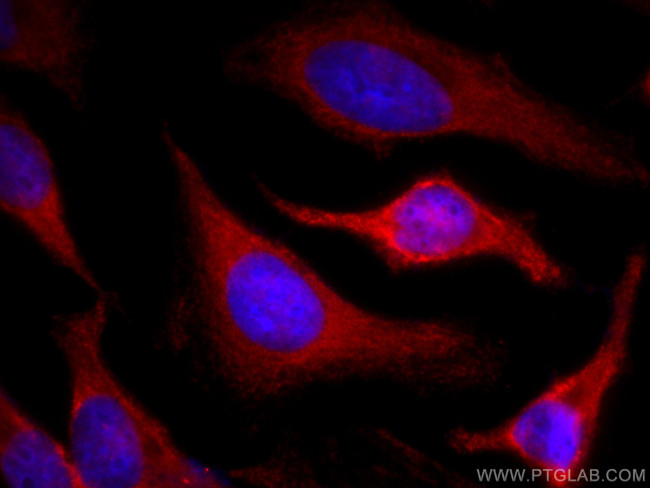 Cyclophilin A Antibody in Immunocytochemistry (ICC/IF)