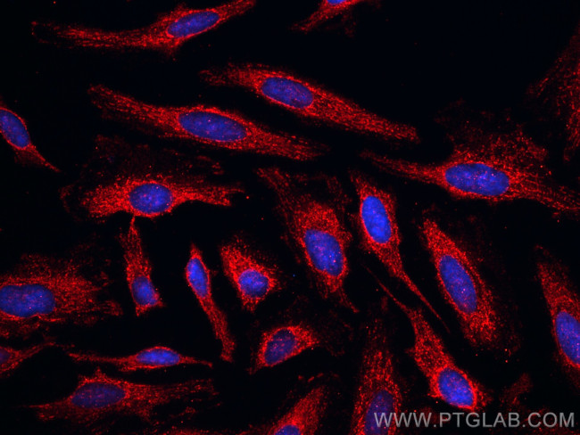 KBTBD2 Antibody in Immunocytochemistry (ICC/IF)