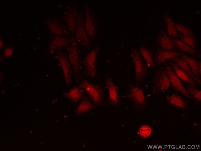 Importin Alpha 5 Antibody in Immunocytochemistry (ICC/IF)