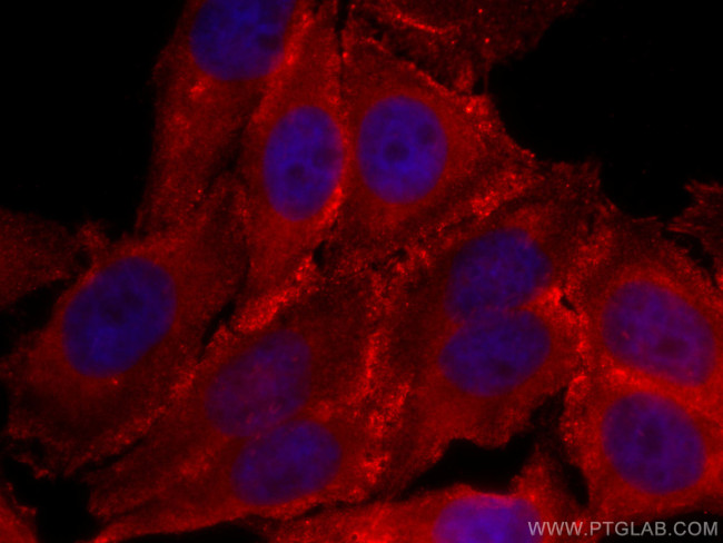 CARS Antibody in Immunocytochemistry (ICC/IF)