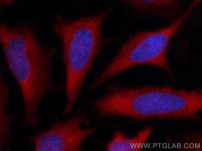 GART Antibody in Immunocytochemistry (ICC/IF)