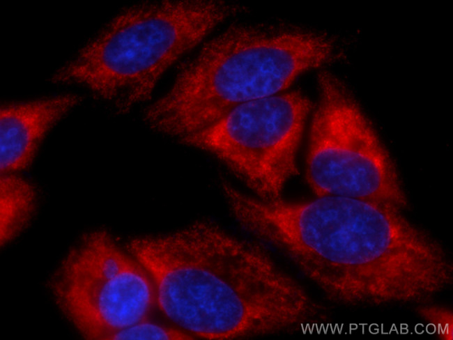 ATG16L1 Antibody in Immunocytochemistry (ICC/IF)