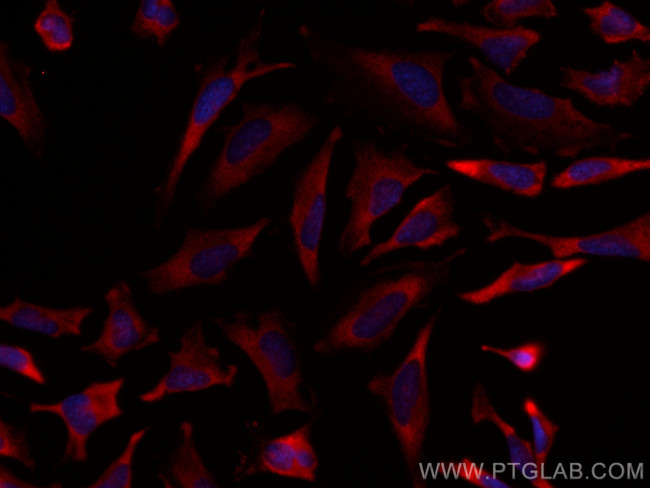 ABCE1 Antibody in Immunocytochemistry (ICC/IF)