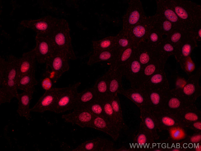 MCM6 Antibody in Immunocytochemistry (ICC/IF)