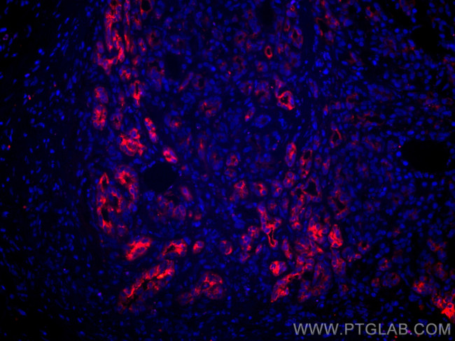 MMP7 Antibody in Immunohistochemistry (PFA fixed) (IHC (PFA))