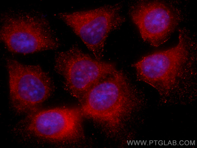 NCAPG Antibody in Immunocytochemistry (ICC/IF)