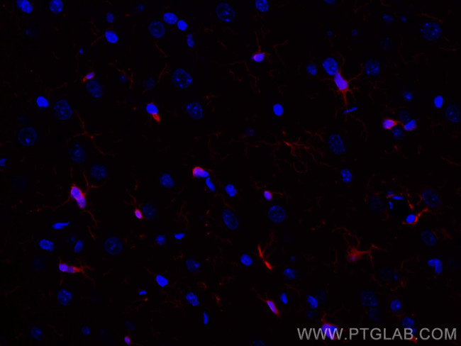 IBA1 Antibody in Immunohistochemistry (PFA fixed) (IHC (PFA))