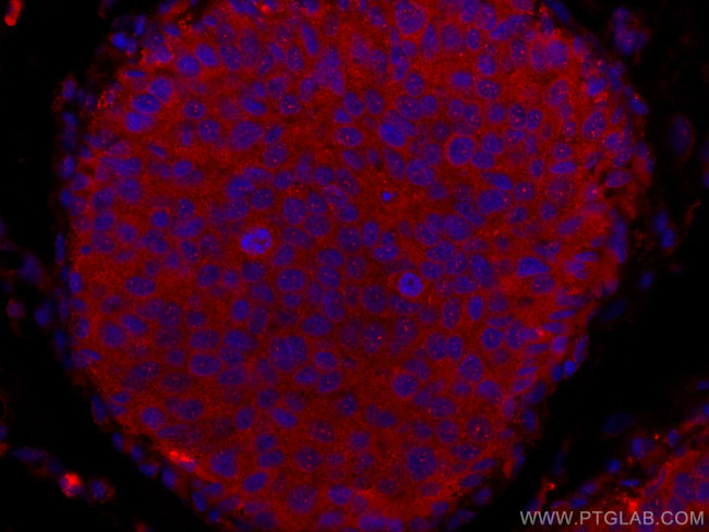 NDE1 Antibody in Immunohistochemistry (Paraffin) (IHC (P))