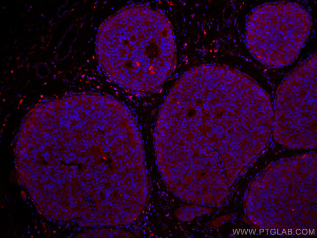 NDE1 Antibody in Immunohistochemistry (Paraffin) (IHC (P))