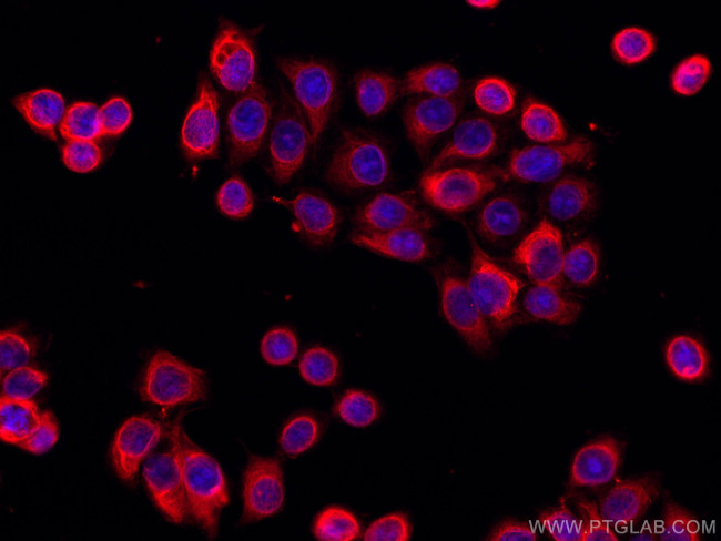 MMP9 Antibody in Immunocytochemistry (ICC/IF)