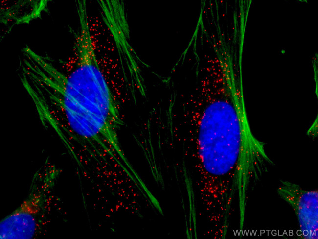 PEX14 Antibody in Immunocytochemistry (ICC/IF)