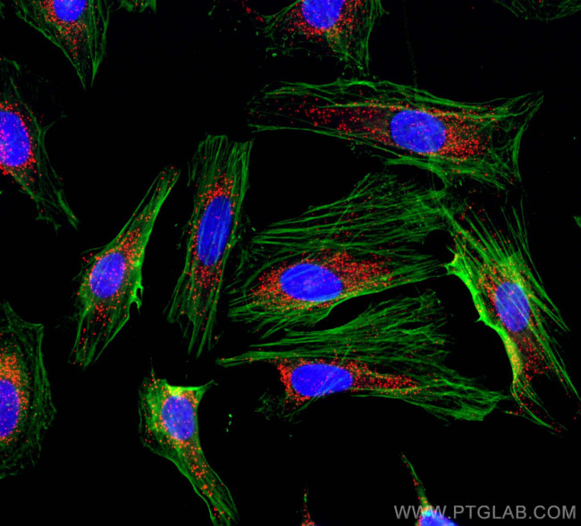 PEX14 Antibody in Immunocytochemistry (ICC/IF)