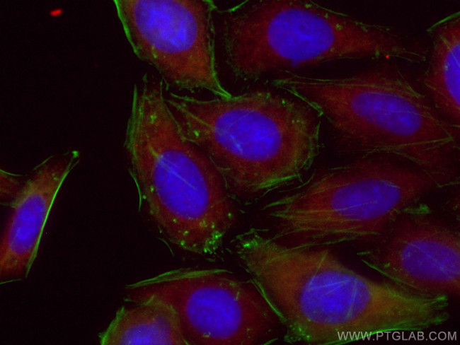 NF-kappa B p65 Antibody in Immunocytochemistry (ICC/IF)