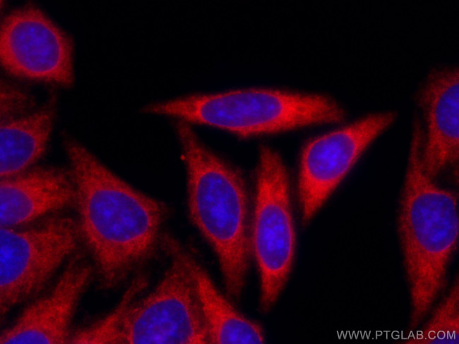 NF-kappa B p65 Antibody in Immunocytochemistry (ICC/IF)