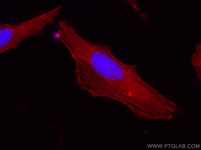 Palladin Antibody in Immunocytochemistry (ICC/IF)