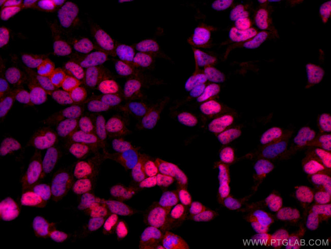 DACH1 Antibody in Immunocytochemistry (ICC/IF)