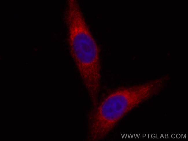 PLOD3 Antibody in Immunocytochemistry (ICC/IF)