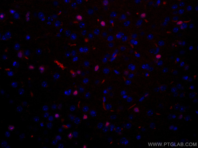 SOX2 Antibody in Immunohistochemistry (Paraffin) (IHC (P))