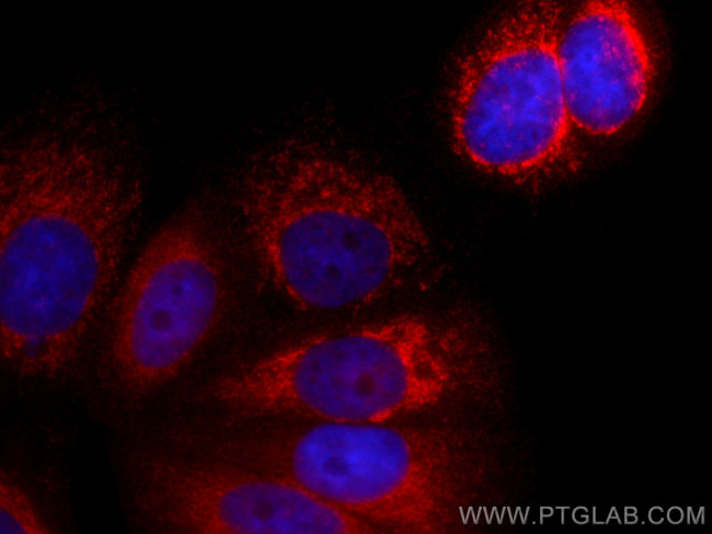 YME1L1 Antibody in Immunocytochemistry (ICC/IF)