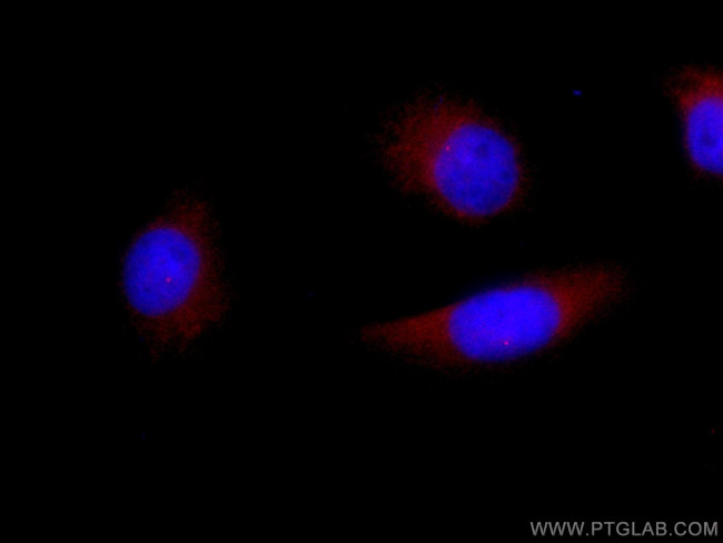 FBF1 Antibody in Immunocytochemistry (ICC/IF)