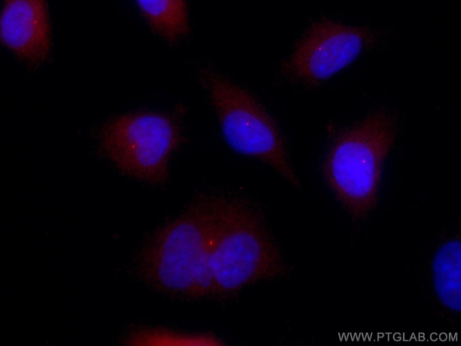 FBF1 Antibody in Immunocytochemistry (ICC/IF)