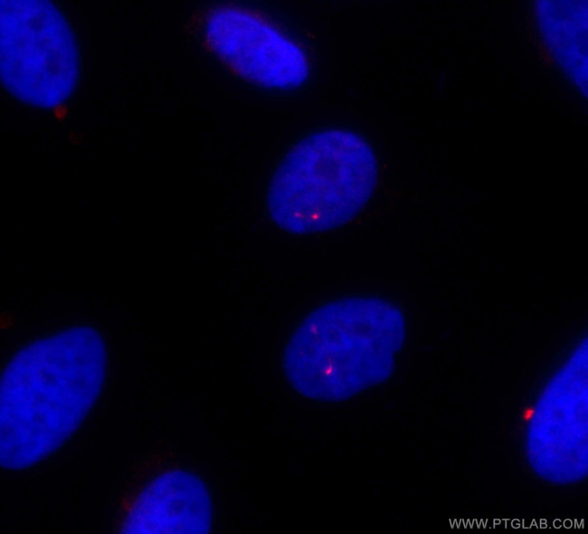 IFT81 Antibody in Immunocytochemistry (ICC/IF)