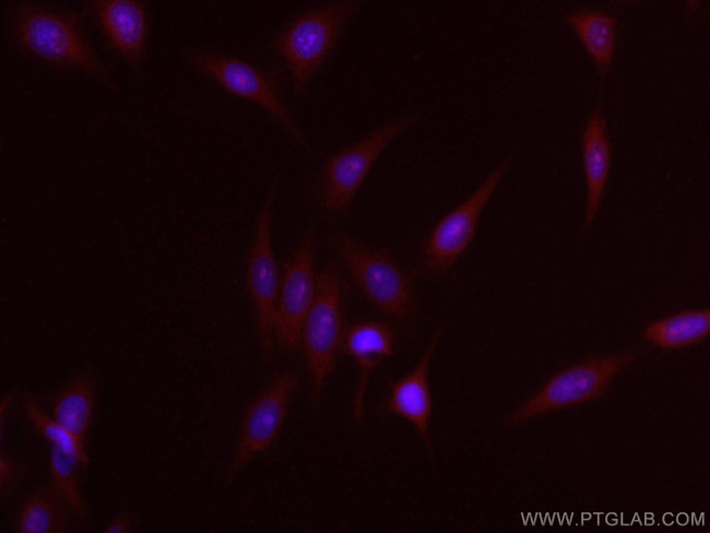 COMMD1 Antibody in Immunocytochemistry (ICC/IF)