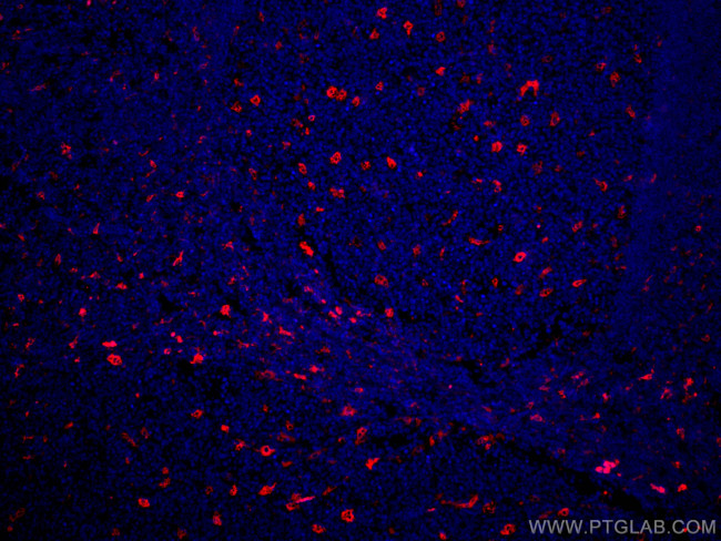 TIMD4 Antibody in Immunohistochemistry (Paraffin) (IHC (P))