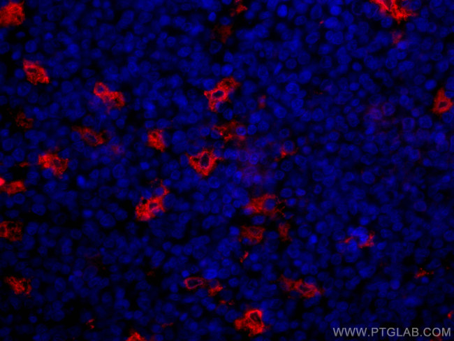 TIMD4 Antibody in Immunohistochemistry (Paraffin) (IHC (P))