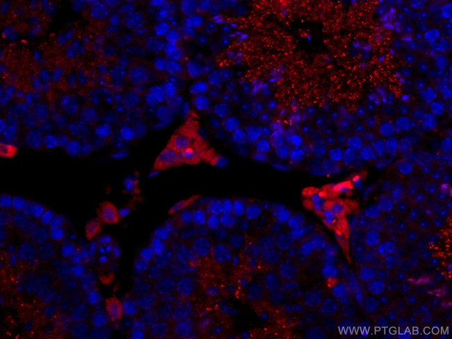 STAR Antibody in Immunohistochemistry (Paraffin) (IHC (P))