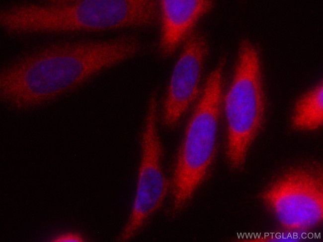 RAB3IP/Rabin8 Antibody in Immunocytochemistry (ICC/IF)