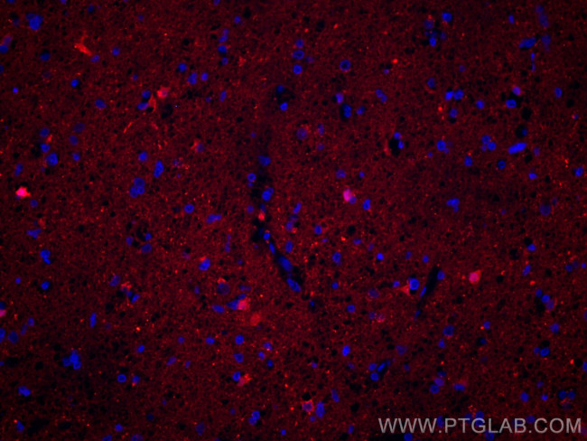 Mu Crystallin Antibody in Immunohistochemistry (Paraffin) (IHC (P))