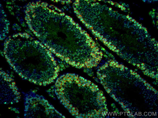 DAZL Antibody in Immunohistochemistry (Paraffin) (IHC (P))