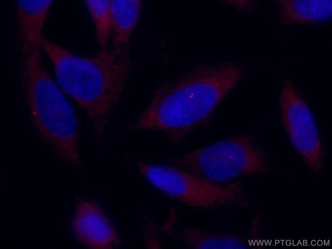 CP110 Antibody in Immunocytochemistry (ICC/IF)