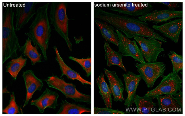 G3BP1 Antibody in Immunocytochemistry (ICC/IF)