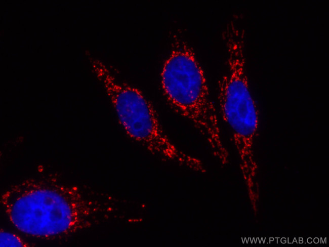 PYCR1 Antibody in Immunocytochemistry (ICC/IF)