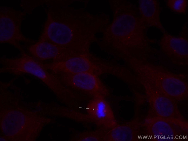 SDCCAG8 Antibody in Immunocytochemistry (ICC/IF)