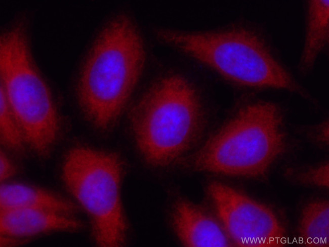 Spartin, SPG20 Antibody in Immunocytochemistry (ICC/IF)