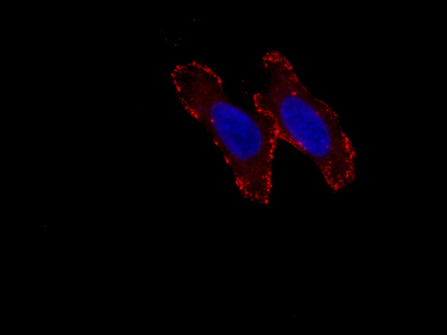 Liprin Alpha 1 Antibody in Immunocytochemistry (ICC/IF)