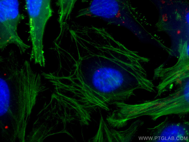 CEP250/CNAP1 Antibody in Immunocytochemistry (ICC/IF)