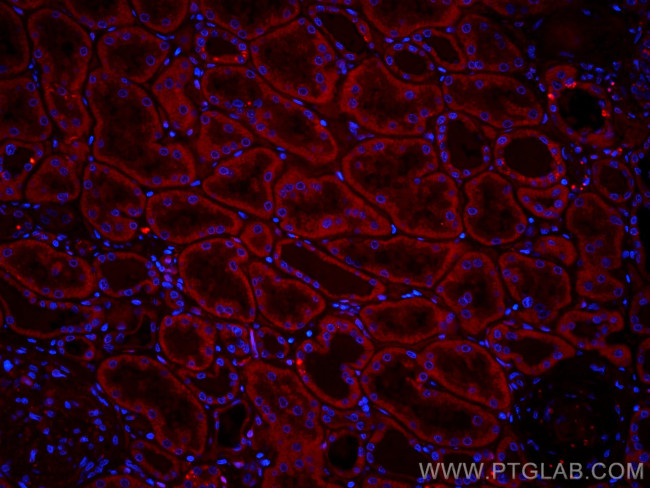 RBP7 Antibody in Immunohistochemistry (Paraffin) (IHC (P))