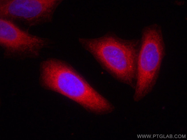 RAB11A/B Antibody in Immunocytochemistry (ICC/IF)