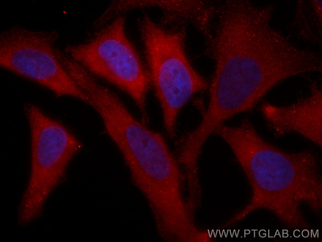 NBR1 Antibody in Immunocytochemistry (ICC/IF)