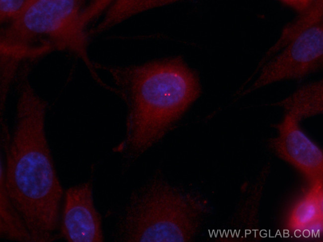 CEP63 Antibody in Immunocytochemistry (ICC/IF)