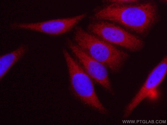 NRF2, NFE2L2 Antibody in Immunocytochemistry (ICC/IF)