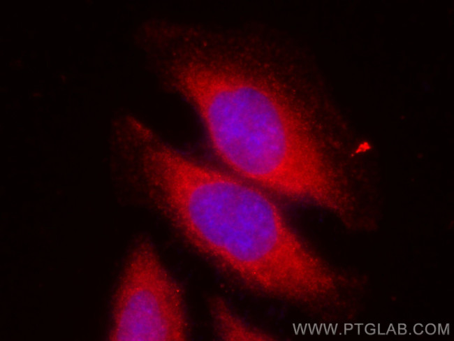 NRF2, NFE2L2 Antibody in Immunocytochemistry (ICC/IF)